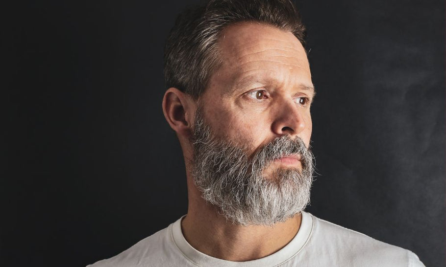 Beard Dandruff and Seborrheic Dermatitis: Causes, Prevention, & Natural Treatment
