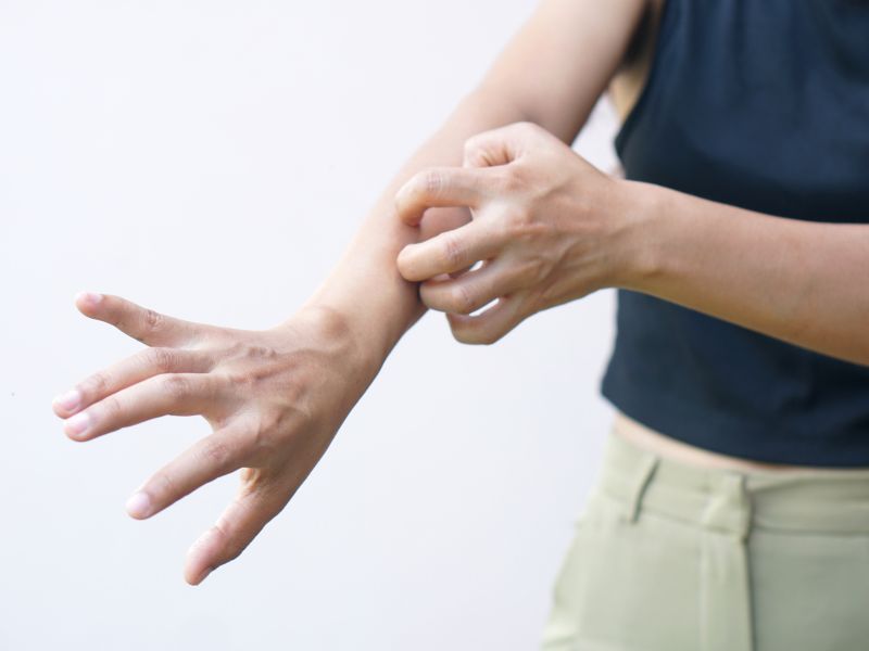 comparing symptoms and management options of common skin conditions
