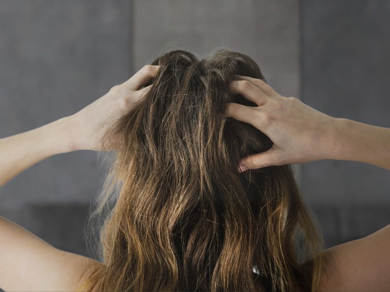 how to pronounce seborrheic dermatitis, girl scratching scalp