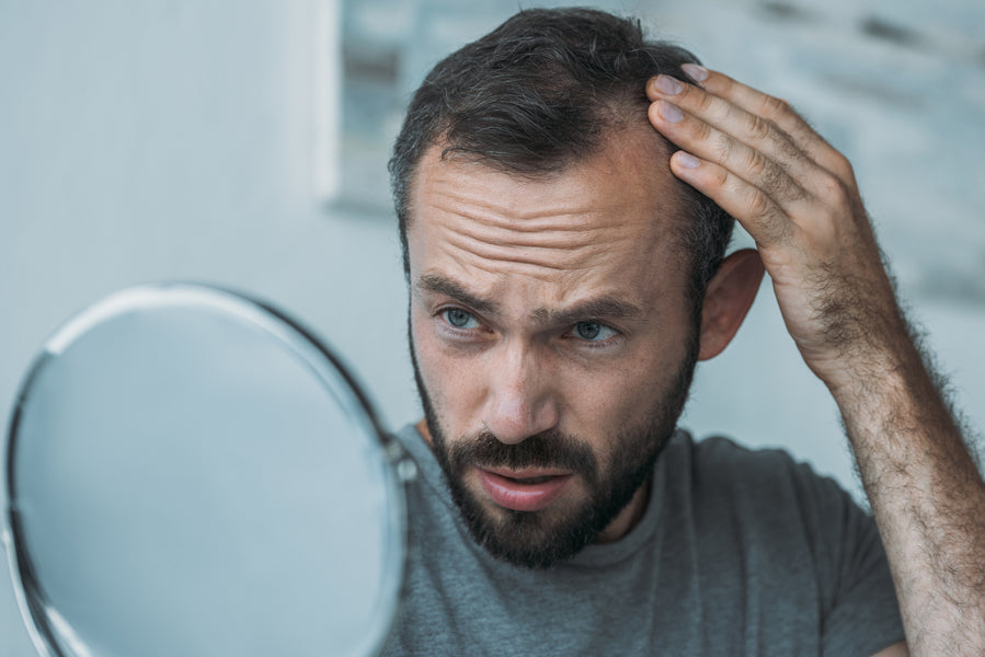 Seborrheic Dermatitis Hair Loss: Natural Treatments to Regrow Hair